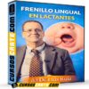 Frenillo lingual en lactantes de Luis Ruiz Frenillo lingual en lactantes de Luis Ruiz